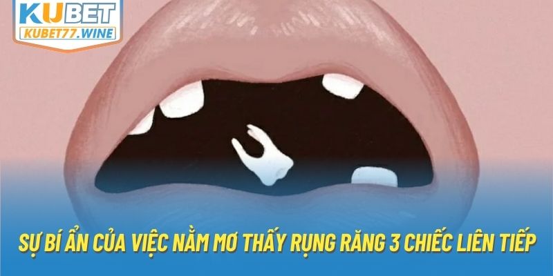 Sự bí ẩn của việc nằm mơ thấy rụng răng 3 chiếc liên tiếp